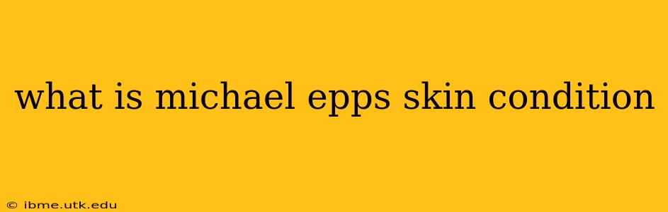 what is michael epps skin condition